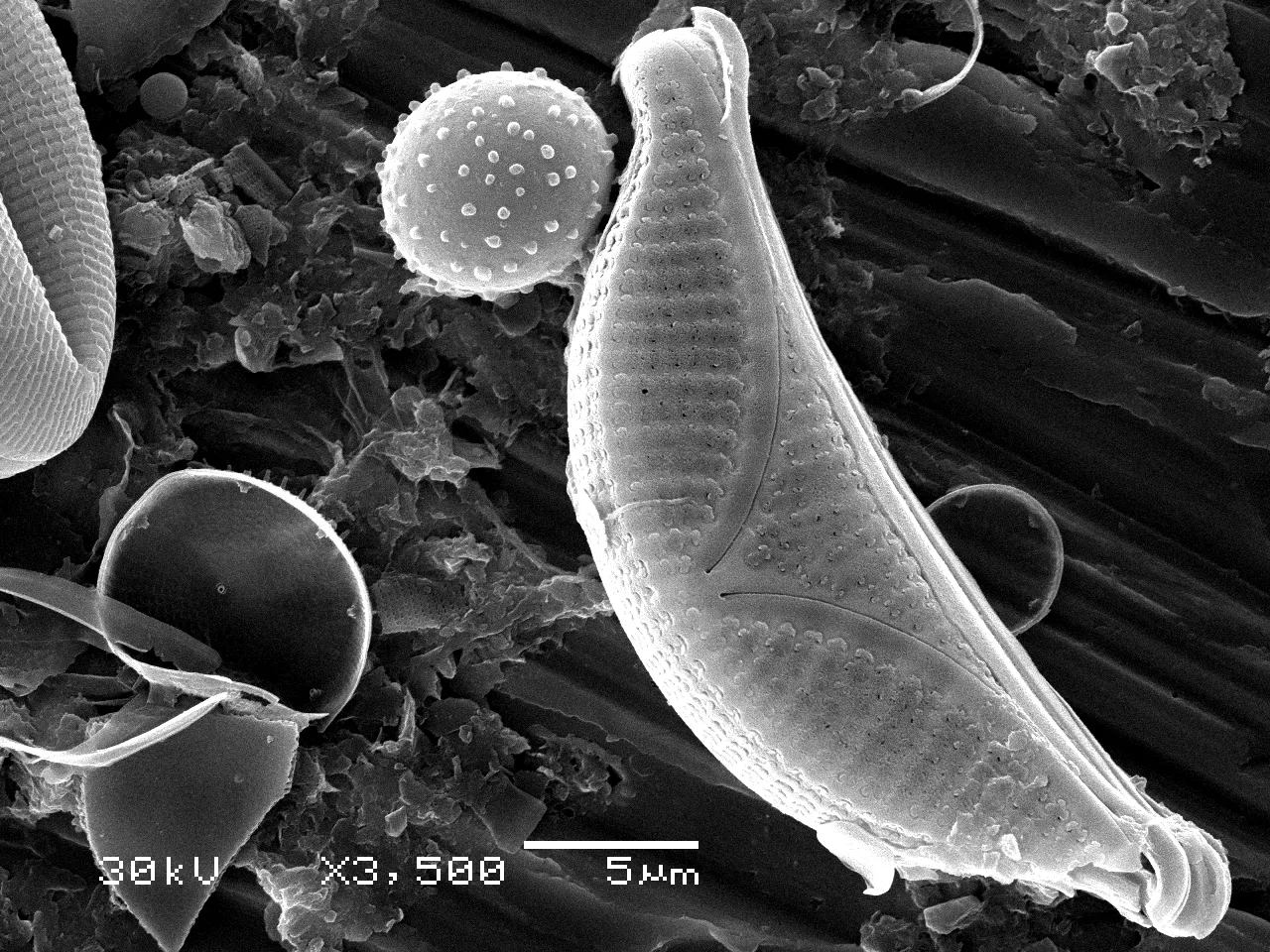 Are Diatoms Producers? Diatom Food Chain Position and Role