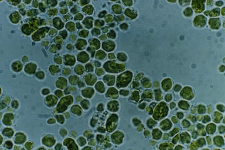 Is Algae a Producer? Algae Food Chain Position and Role