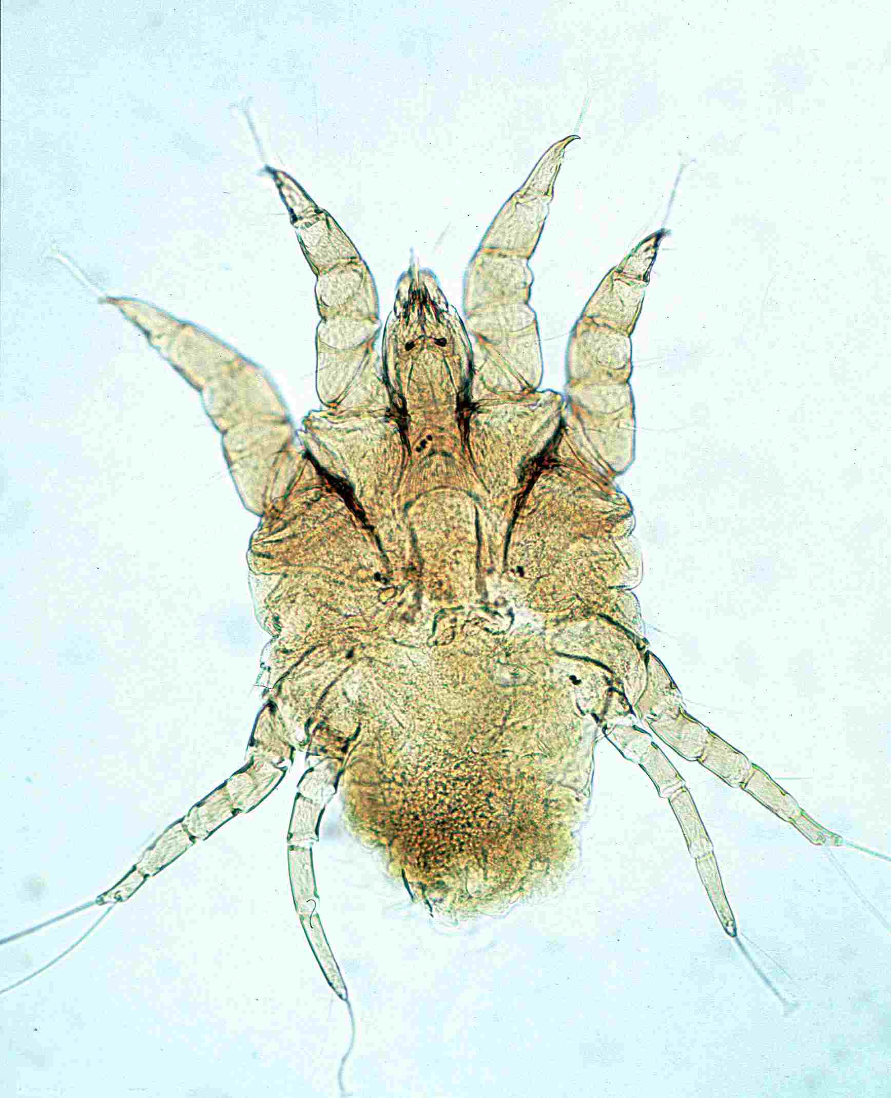 Decomposers in The Tundra: Arctic Mites May Exhibit Detritivorous Feeding Behavior (Credit: Alan R Walker 2012 .CC BY-SA 3.0.)