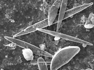 Components of the Freshwater Food Chain: As this Micrograph Shows, Diatoms are Unicellular Algae Encased in Intricate Silica Shells (Credit: Berezovska 2016 .CC BY-SA 4.0.)